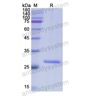 Recombinant Human MMUT, N-His