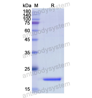 Recombinant Human IL10, C-His