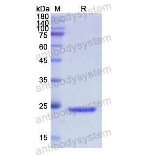 Recombinant Human ACHE, N-His