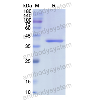 Recombinant Human CD334/FGFR4, N-His