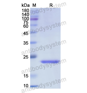 Recombinant Human FDXR, N-His