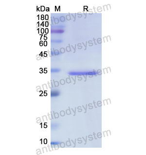 Recombinant Human Calretinin/CALB2, N-His