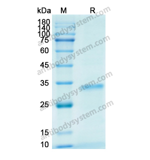 Recombinant Human IGFBP4, N-His