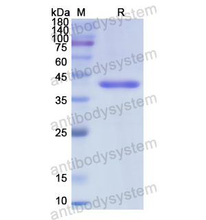 Recombinant Human TGM1, N-His