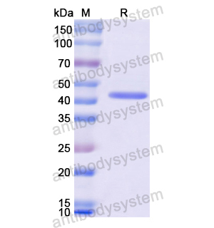 Recombinant Human FECH, N-His