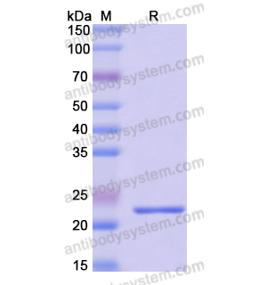 Recombinant Human GLDC, N-His