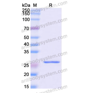Recombinant Human WARS1, N-His