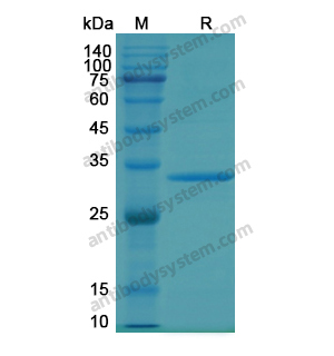 Recombinant Human JAK1, N-His