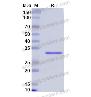 Recombinant Human PTPRB, N-His