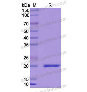 Recombinant Human PTPRZ1, N-His