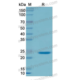 Recombinant Human SP100, N-His