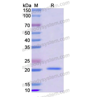 Recombinant Human CFL1, N-His