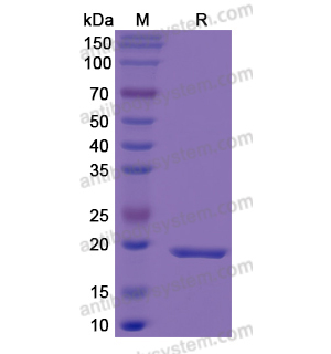 Recombinant Human DTYMK, N-His