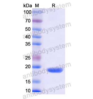 Recombinant Human AZGP1, N-His