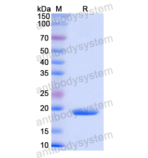 Recombinant Human MPST, N-His