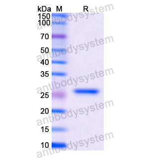 Recombinant Human CTSS
