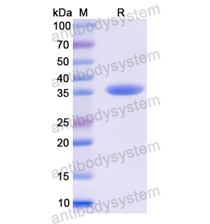 Recombinant Human UCP1, N-His