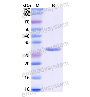 Recombinant Human NFKBIA, N-His