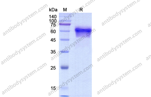 Recombinant Human CD123/IL3RA, C-His