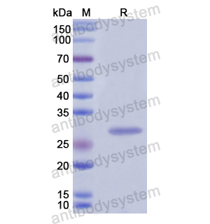 Recombinant Human YWHAQ, N-His