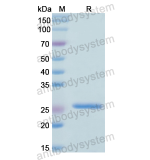 Recombinant Human RPL10, N-His