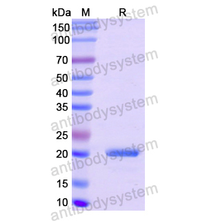 Recombinant Human COL8A1, N-His