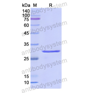 Recombinant Human ABCD3, N-His