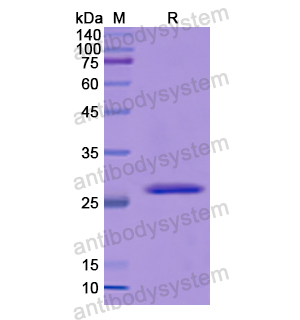 Recombinant Human ITPRID2, N-His
