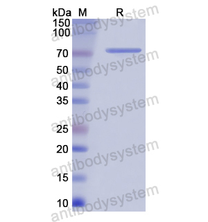 Recombinant Human CHAT, N-His
