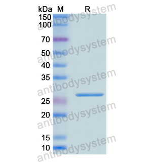 Recombinant Human ACADL, N-His