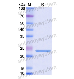 Recombinant Human NDUFS1, N-His