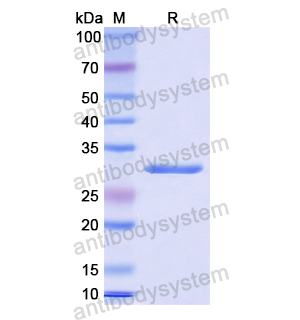 Recombinant Human MAPK1, N-His