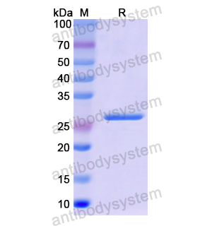 Recombinant Human ERCC5, N-His
