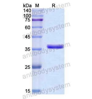 Recombinant Human PCSK1, N-His