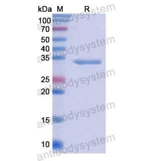 Recombinant Human TKT, N-His