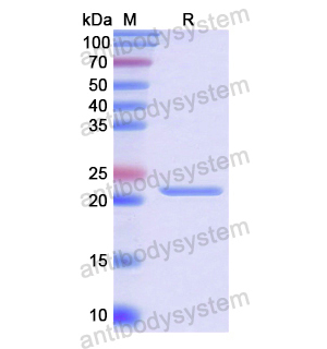 Recombinant Human NOS3, N-His