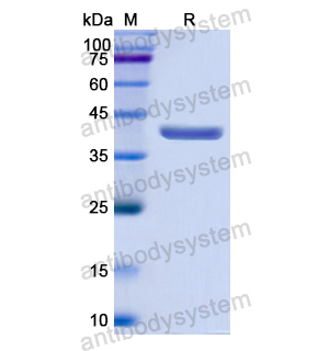 Recombinant Human OAS2, N-His