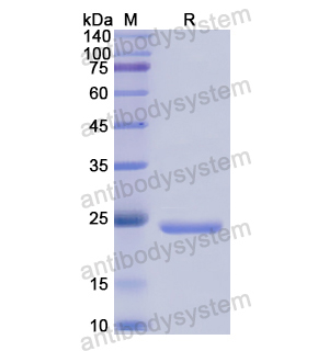 Recombinant Human CDC25B, N-His