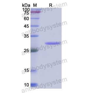 Recombinant Human HMOX2, N-His