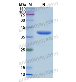 Recombinant Human AXL/UFO, N-His & N-SUMO