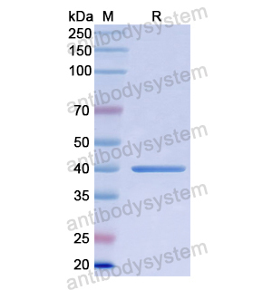 Recombinant Human LRPAP1, N-His