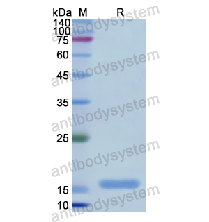 Recombinant Human NTS, N-His