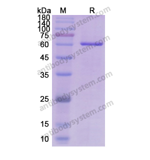 Recombinant Human AKT1, N-His