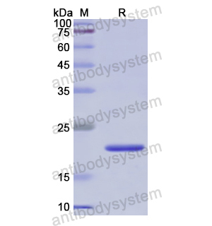 Recombinant Human STIP1, N-His