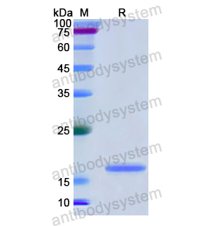 Recombinant Human CD171/L1CAM, N-His