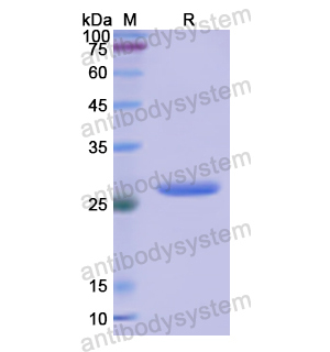 Recombinant Human CD191/CCR1, N-GST