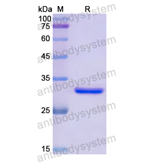 Recombinant Human GRK4, N-His
