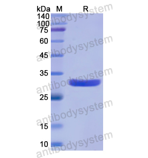 Recombinant Human MCM5, N-His