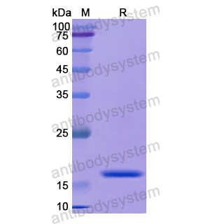 Recombinant Human BMI1, N-His