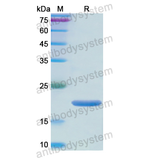 Recombinant Human NOS2, N-His